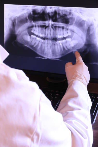 Best Broken or Cracked Tooth Emergency Dentist in Grand Haven, MI