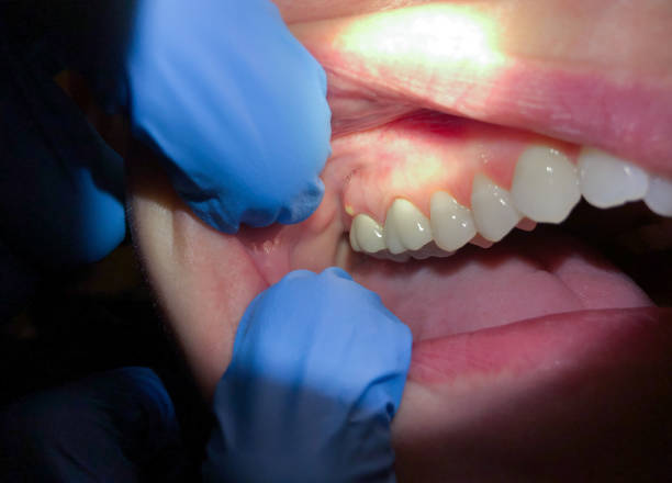 Best Emergency Dentist for Special Needs Patients in Grand Haven, MI