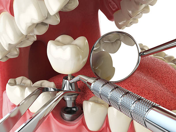 Best Emergency Dental Services for Seniors in Grand Haven, MI